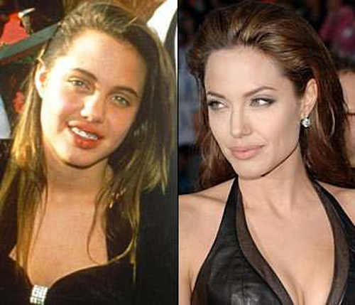 Celebrities Before and After Fame